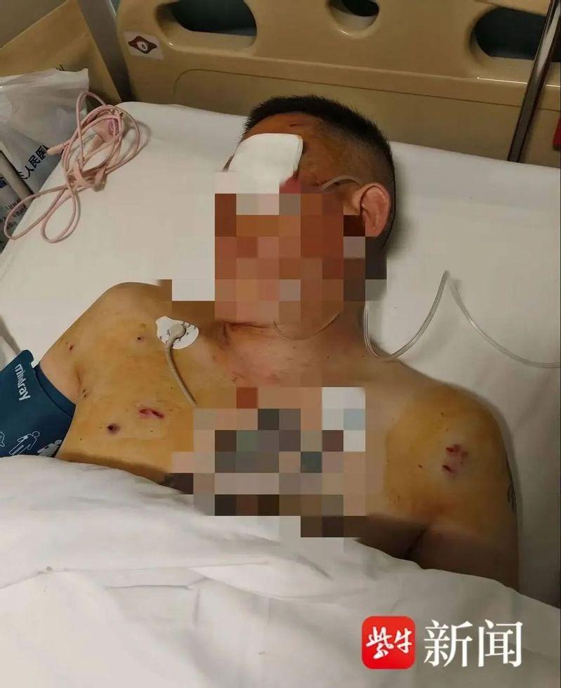 倪男遇搶受傷左眼失明。（取材自紫牛新聞）