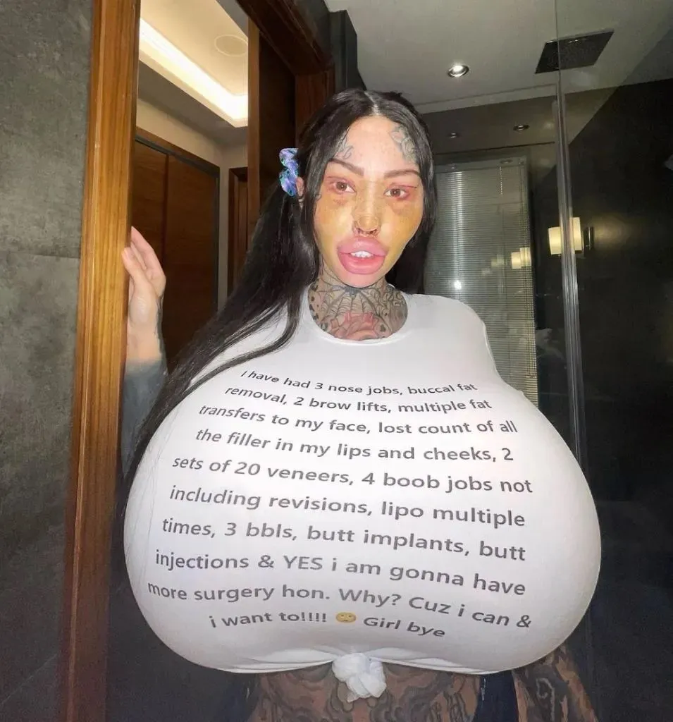 把胸隆炸的网红猝逝!网疑自杀 死前已成外星人 把胸隆炸的网红猝逝!网疑自杀 死前已成外星人