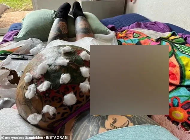 把胸隆炸的网红猝逝!网疑自杀 死前已成外星人 把胸隆炸的网红猝逝!网疑自杀 死前已成外星人