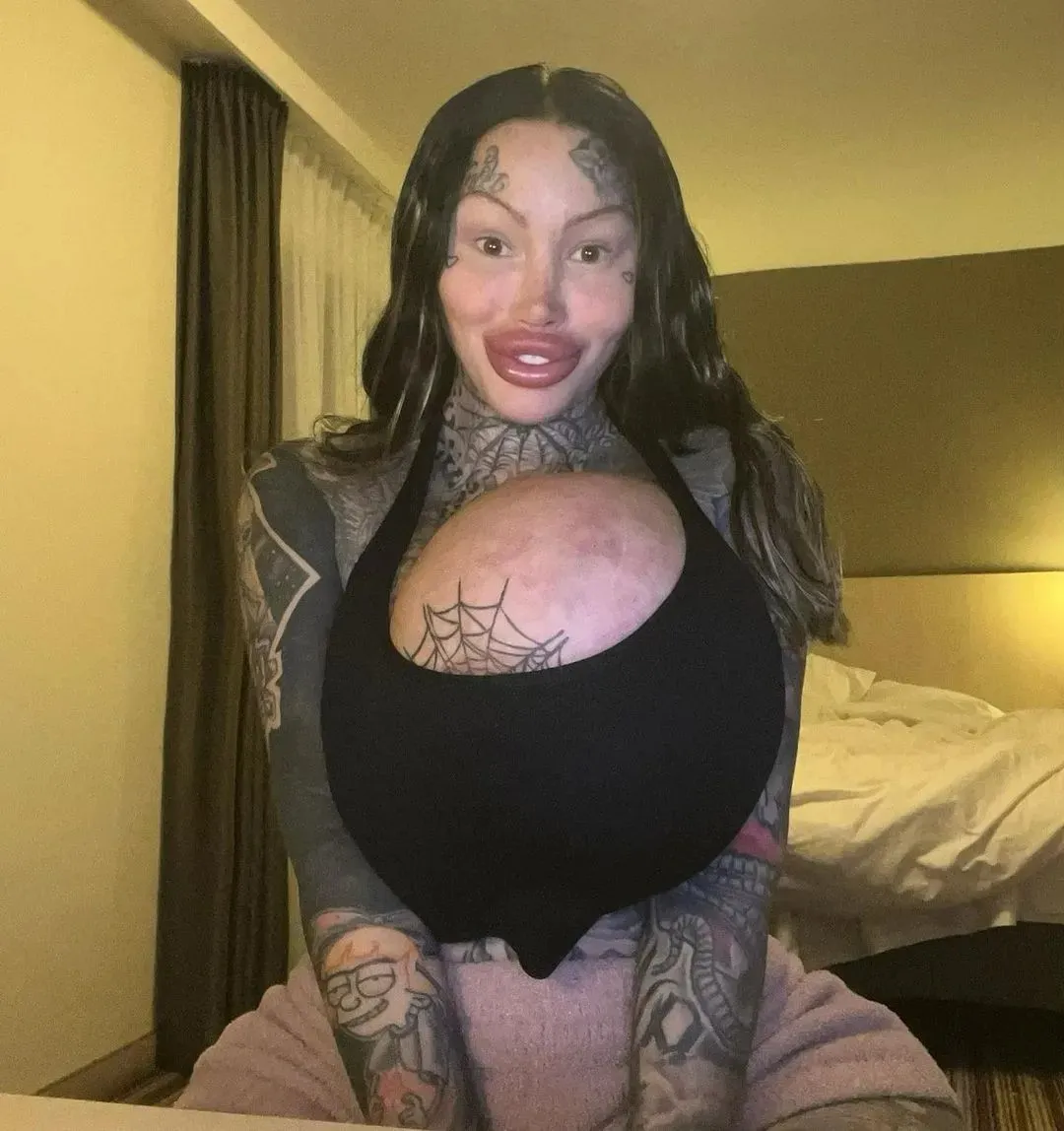 把胸隆炸的网红猝逝!网疑自杀 死前已成外星人 把胸隆炸的网红猝逝!网疑自杀 死前已成外星人