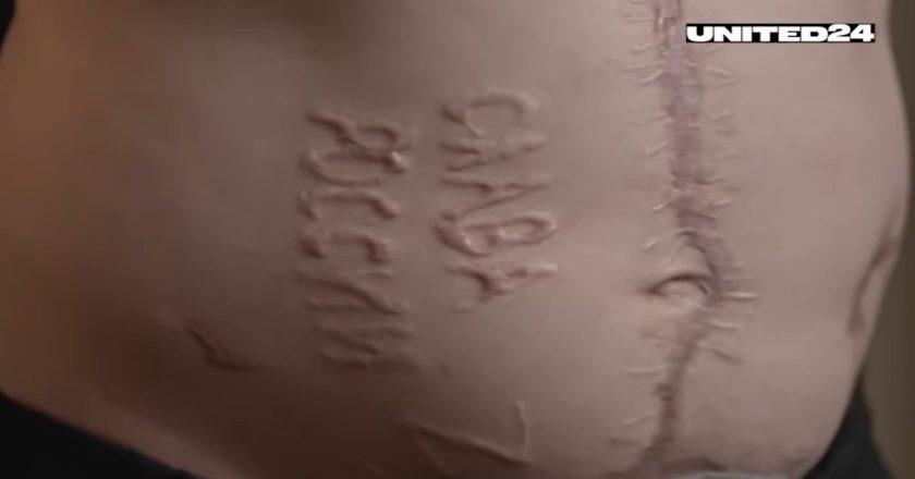 联国爆俄凌虐乌战俘 苏联时代手法烙印「打电话给普亭」