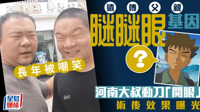 常被嘲睁眼跟闭眼一样 眯眯眼大叔动刀开眼