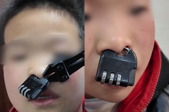 中国熊孩子“密码锁卡鼻” 消防员当面吐槽