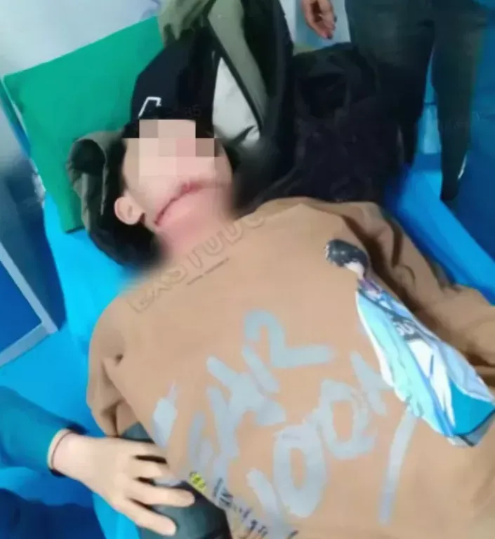 13岁男孩被老人拉绳锁喉,已赴京治疗脱离危险