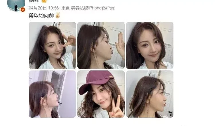44岁杨蓉近况曝光!晒面部烫伤恢复照片上热搜