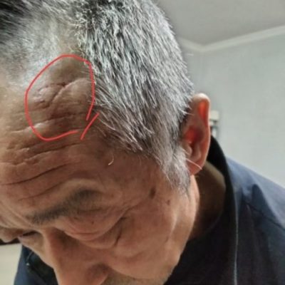 【追踪2】“一条命只值两万？”案后续：父亲进京遭殴打 警方：进一步核查