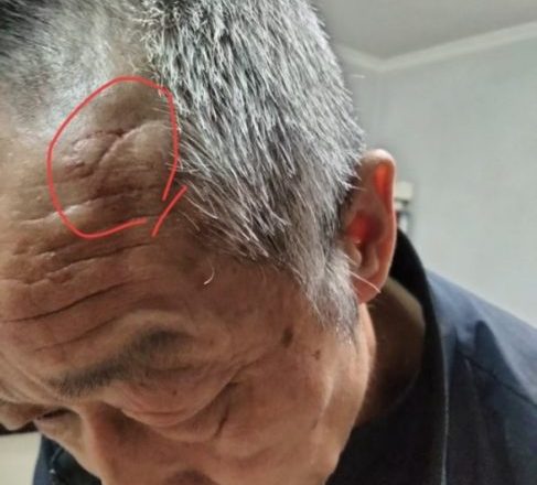 【追踪2】“一条命只值两万?”案后续:父亲进京遭殴打 警方:进一步核查