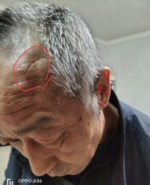 【追踪2】“一条命只值两万？”案后续：父亲进京遭殴打 警方：进一步核查