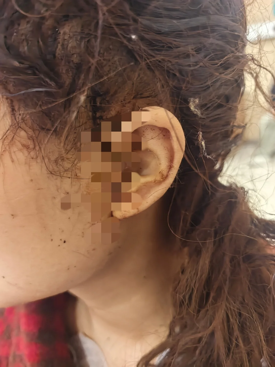 16岁女孩称被闺蜜刺成重伤,事发后对方自杀身亡,当事人回应