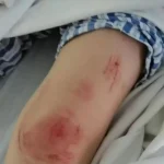 河北女子遭家暴驾车逃跑致丈夫身亡案二审维持原判