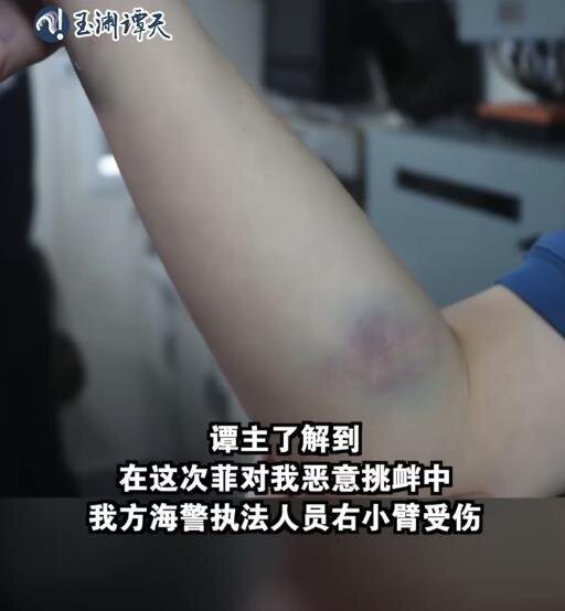 央视旗下「玉渊谭天」21日晚发文,「在这次菲对我恶意挑衅中,我方海警有执法人员右... 央视旗下「玉渊谭天」21日晚发文,「在这次菲对我恶意挑衅中,我方海警有执法人员右...